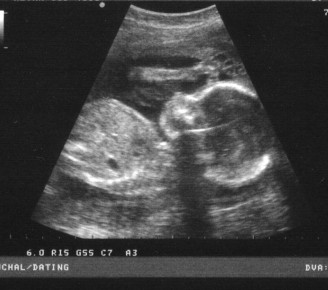Recommended Reading on Protecting the Unborn